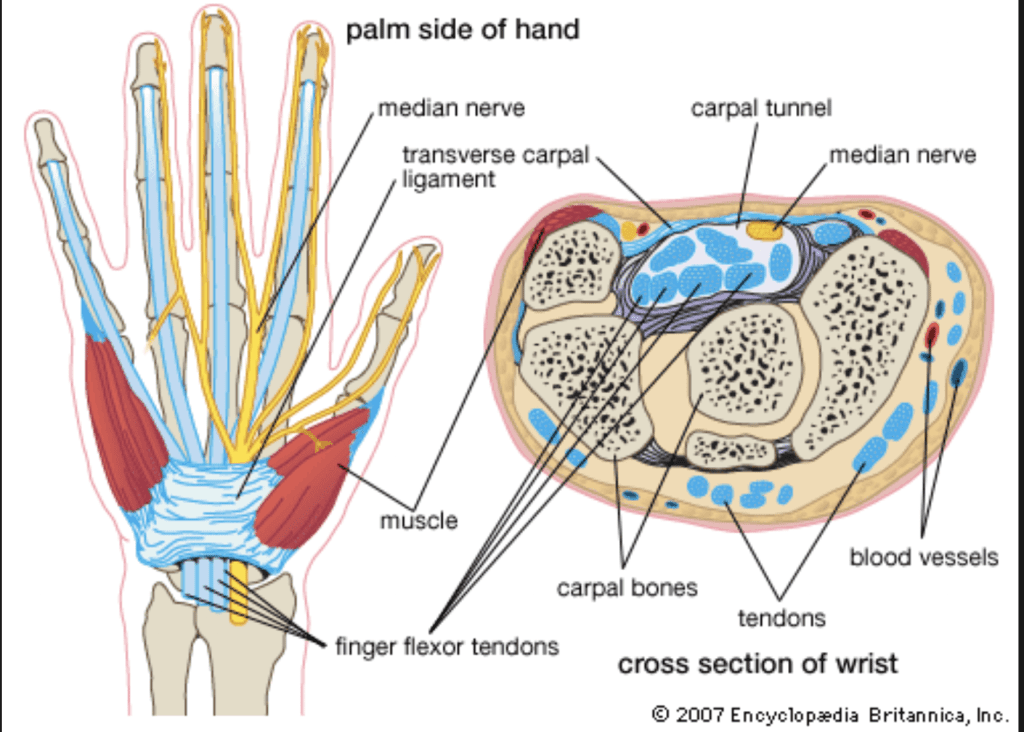 carpal tunnel syndrome